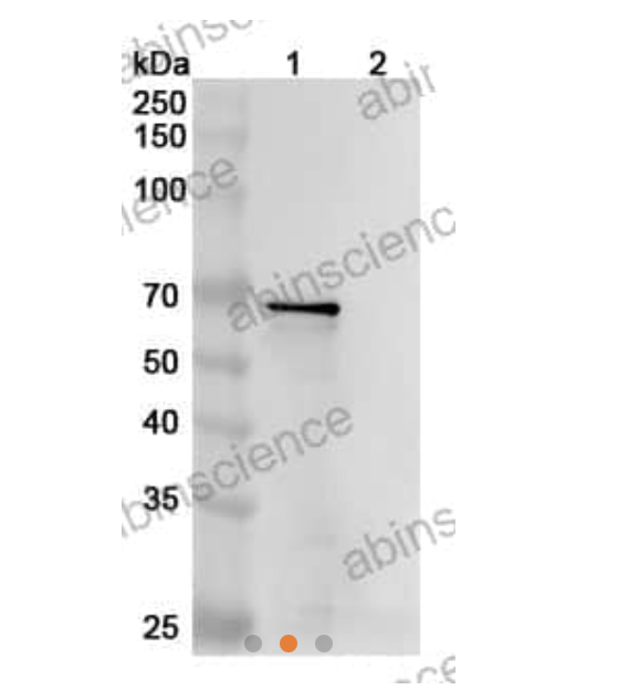 Abinscience Anti-Human Tau Reference Antibody (DC8E8, RUO) (HY086013)