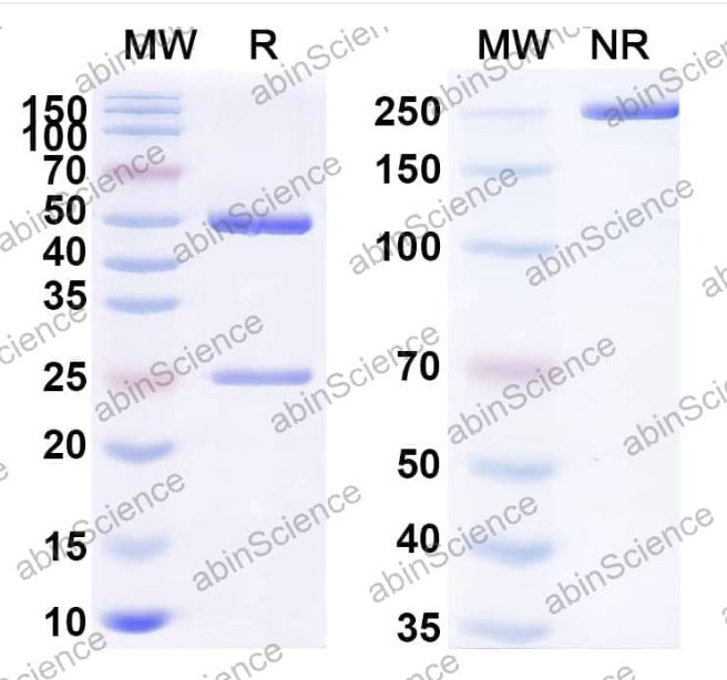 Abinscience Anti-Human APP Recombinant Antibody (m266) (HY235103)