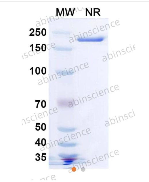 Abinscience Anti-Human TREM2 Recombinant Antibody (SAA0548) (HV166107)