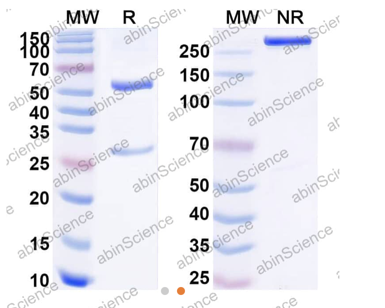 Abinscience Anti-Human APP Recombinant Antibody (21F12) (HP849013)