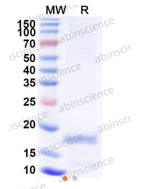 Abinscience Human APP Recombinant Protein (N-His) (HY235022)