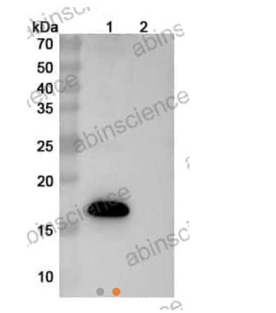 Abinscience Human APP Recombinant Protein (N-His) (HY235022)