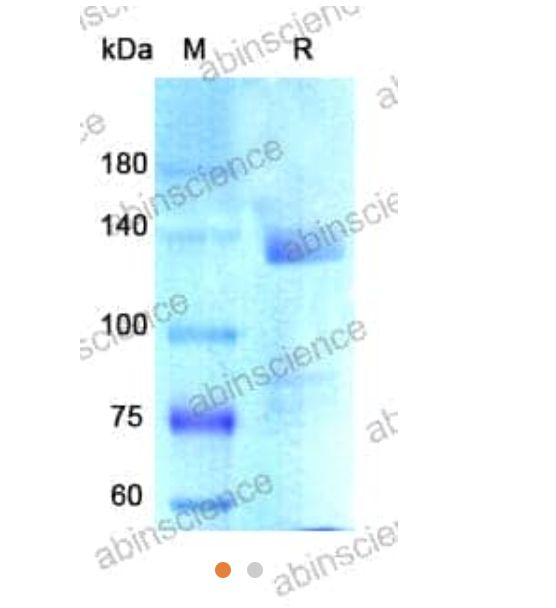 Abinscience Human APP Recombinant Protein (C-Fc) (HY235011)