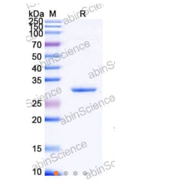 Abinscience Human TREM2 Recombinant Protein (N-His-SUMO) (HV166032)