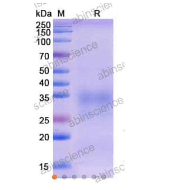 Abinscience Human TREM2 Recombinant Protein (C-His) (HV166021)