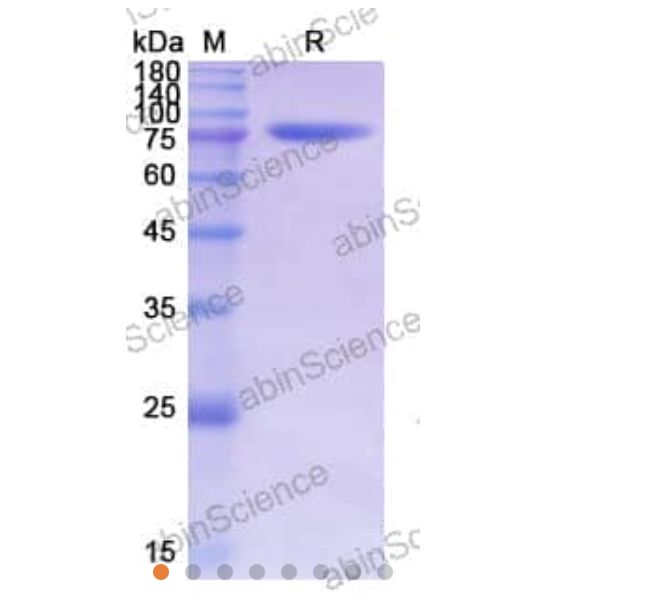 Abinscience Human Tau Recombinant Protein (C-His) (HY086012)