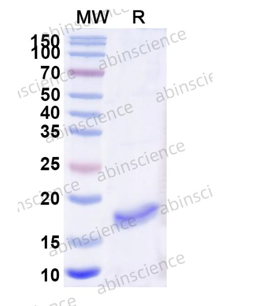 Abinscience Anti-Human Tau Recombinant Nanobody (SAA1351) (HY086173)