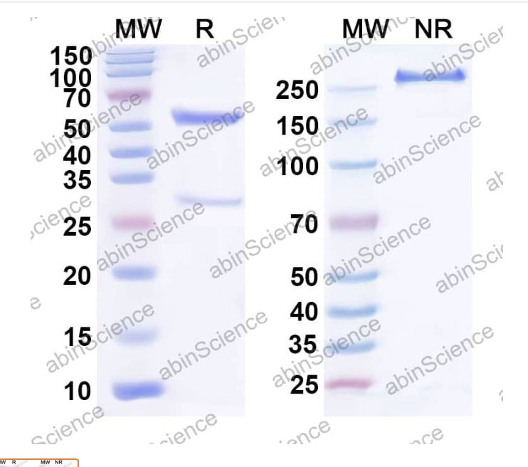 Abinscience Anti-Human APP/Protease Nexin II Reference Antibody (Merinetug, RUO) (HY235296)