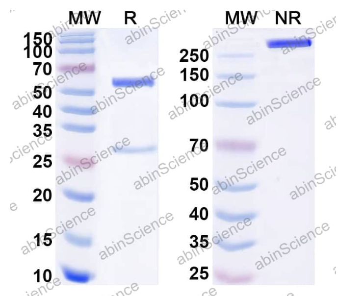 Abinscience Anti-Human Abeta40/Beta-APP40 Recombinant Antibody (SAA1461) (HP529023)