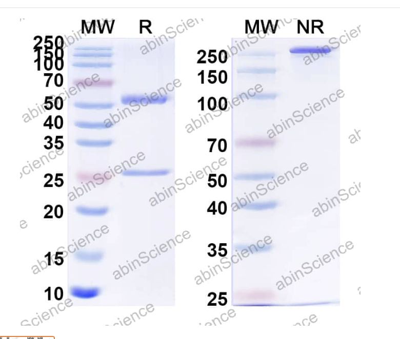 Abinscience Anti-Human APP/Amyloid beta Recombinant Antibody (SAA1460) (HY235023)