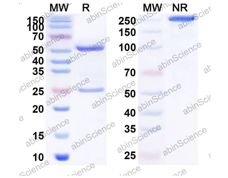 Abinscience Anti-Human APP Recombinant Antibody (PMN310) (HY235133)