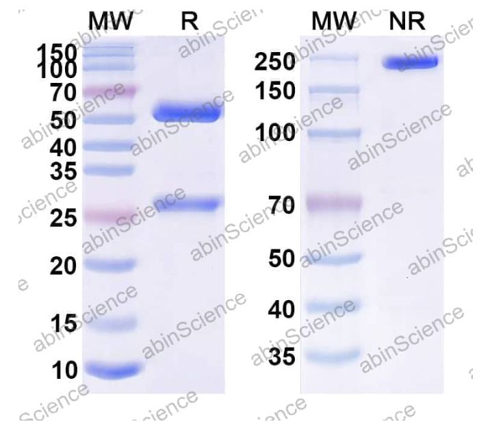 Abinscience Anti-Human APP Reference Antibody (KHK6640, RUO) (HY235096) Abinscience Anti-Human APP Reference Antibody (KHK6640, RUO) (HY235096)