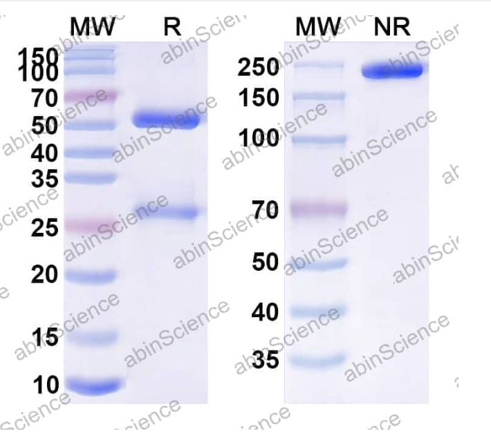 Abinscience Anti-Human APP Reference Antibody (C705, RUO) (HY235216) Abinscience Anti-Human APP Reference Antibody (C705, RUO) (HY235216)