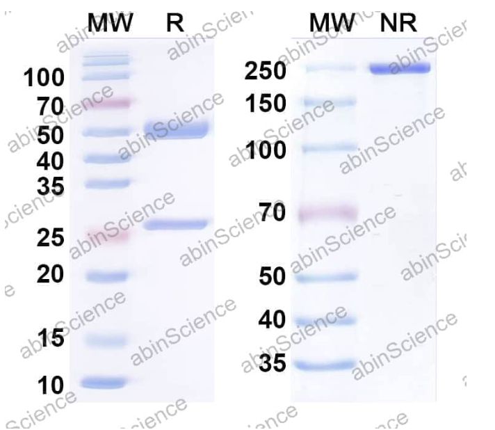 Abinscience Anti-Human TERM2 Reference Antibody (PY314, RUO) (HV166036)