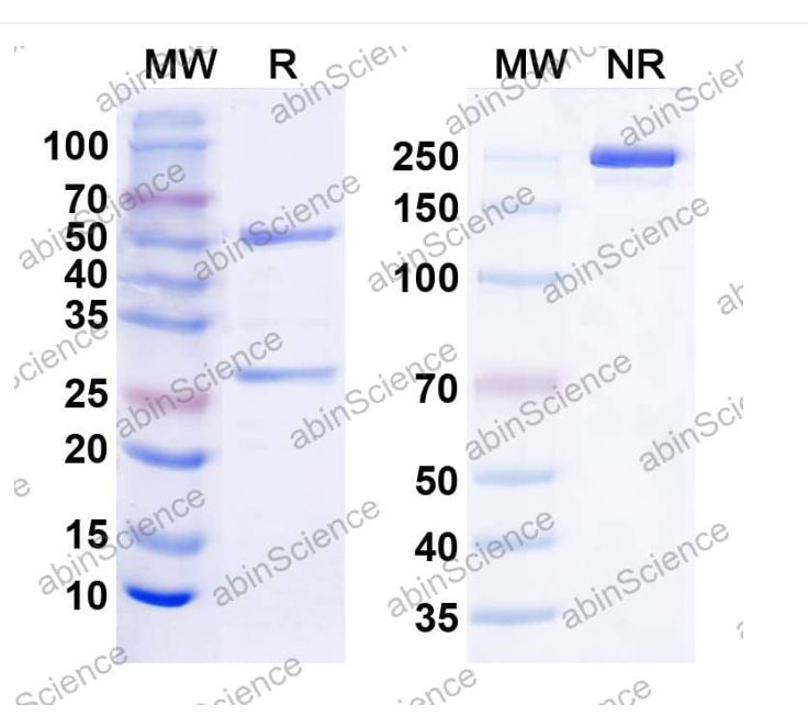 Abinscience Anti-TREM2 Recombinant Antibody (EOS006215) (HV166063)