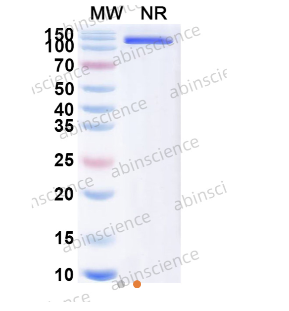 Abinscience Anti-Human TREM2 Recombinant Antibody (SAA2089) (HV166043)