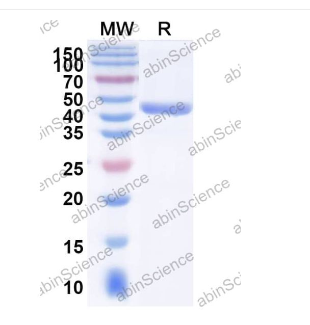 Abinscience Anti-Human TREM2 Recombinant Antibody (SAA2090) (HV166053)