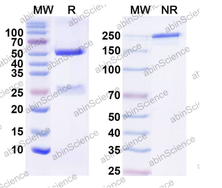Abinscience InVivoMAb Anti-Human TREM2 Antibody (42E8#) (HV166010)