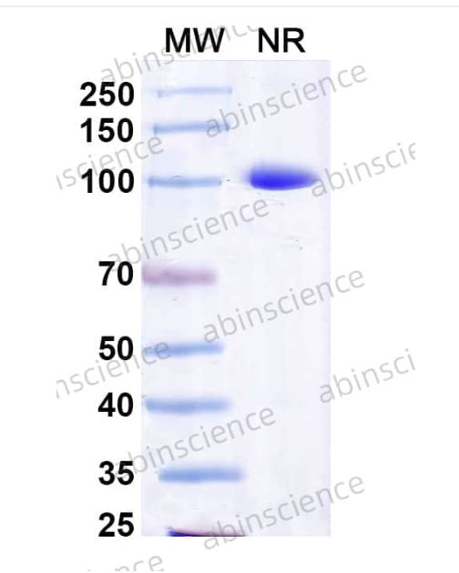 Abinsciemnce Anti-Human Tau Recombinant Antibody (KW1) (HY086133)