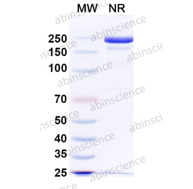 Abinscience Anti-Human Tau Reference Antibody (E2814, RUO) (HY086096)