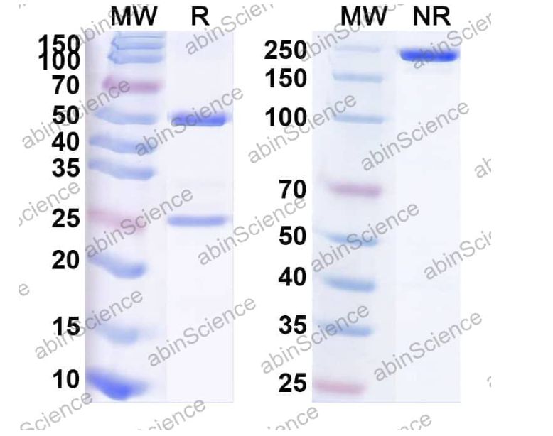 Abinscience Anti-Human Tau Reference Antibody (CBTAU-24.1, RUO) (HY086116)