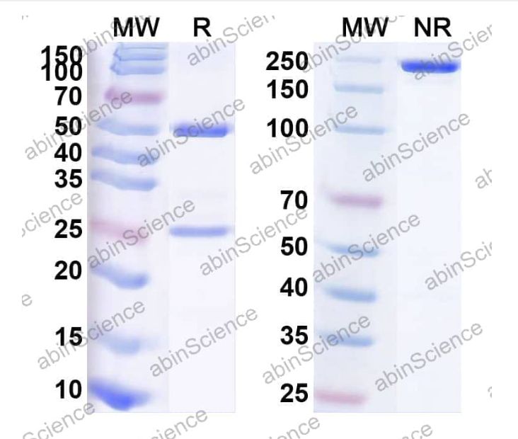 Abinscience Anti-Human Tau Reference Antibody (TBL-100, RUO) (HY086136)