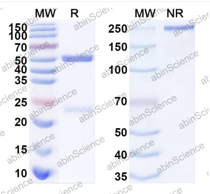 Abinscience Anti-Human APP Recombinant Antibody (12A11) (HY235033)