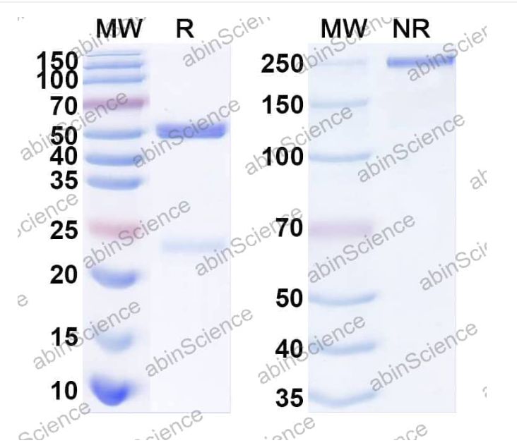 Abinscience Anti-Human APP Recombinant Antibody (10D5) (HY235043)