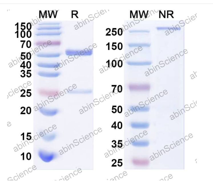 Abinscience Anti-Human APP Recombinant Antibody (PFA1) (HY235073)