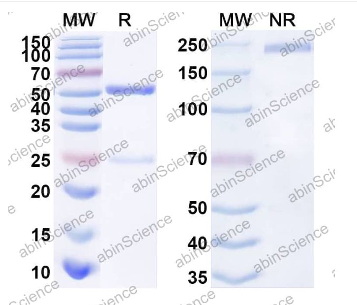 Abinscience Anti-Human APP Recombinant Antibody (12B4) (HY235053)