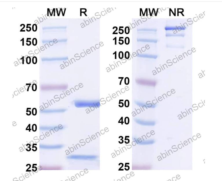 Abinscience InVivoMAb Anti-Human APP Antibody (mAb158) (HY235010)