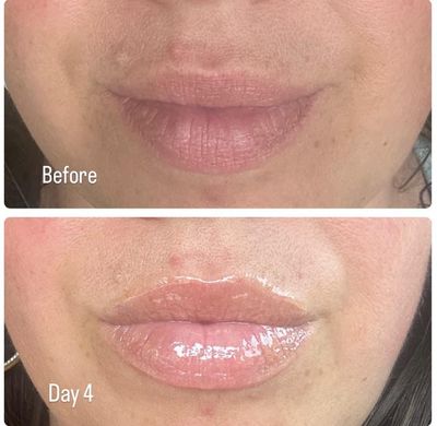 Nu Colour® Peptide Pout