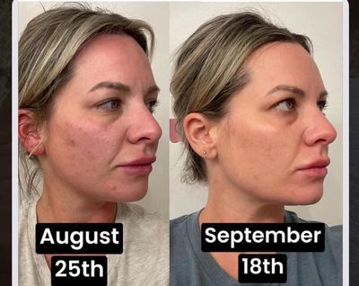 ageLOC® Tru Face® Peptide Retinol Complex