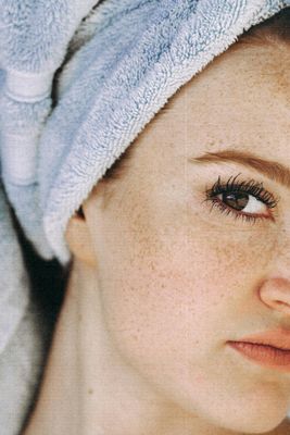 Aging - Fine Lines And Wrinkles