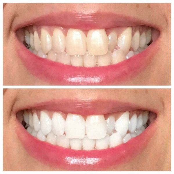 AP 24® Whitening Toothpaste