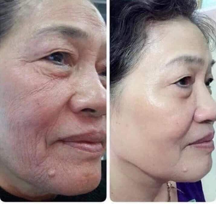 ageLOC® Tru Face® Essence Ultra