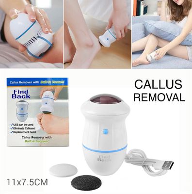 Electric Callus Removal