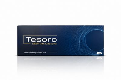 Tesoro Deep