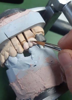 DENTAL