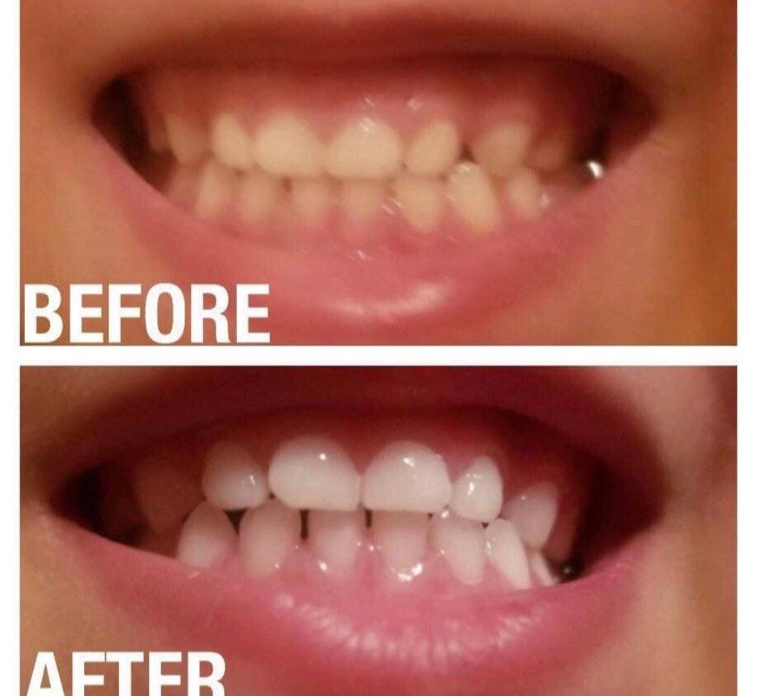 Ap24 Whitening Toothpaste