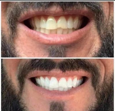 Ap24 Whitening Toothpaste