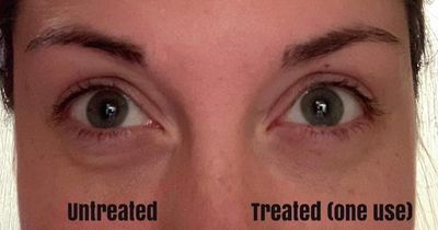 Ideal Eyes Caffeine Treatment