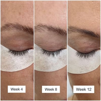 Lash &amp; Brow Serum You