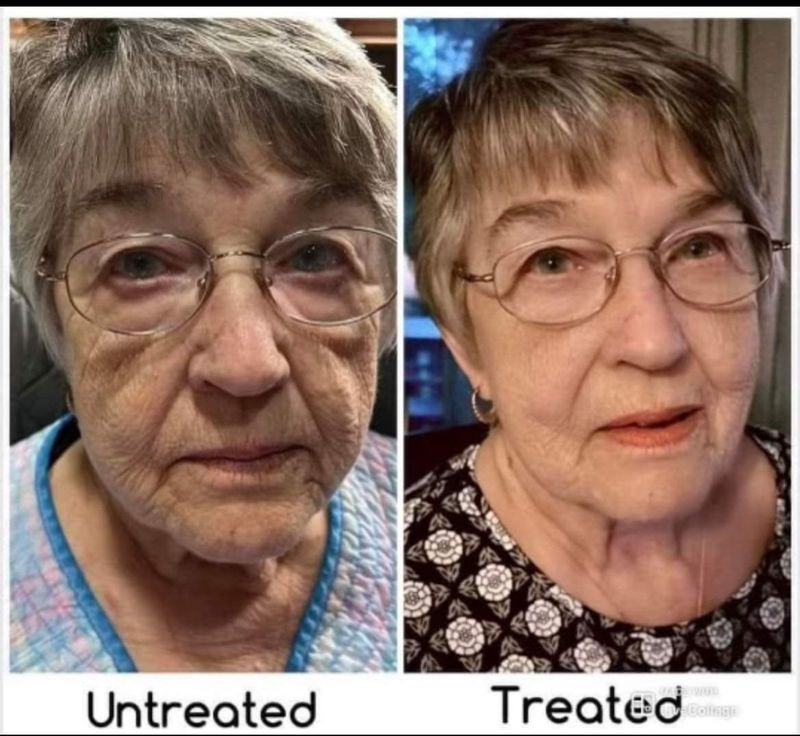 Uplifting cream sale