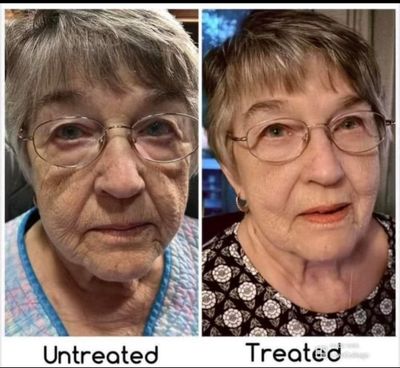 Uplifting cream sale