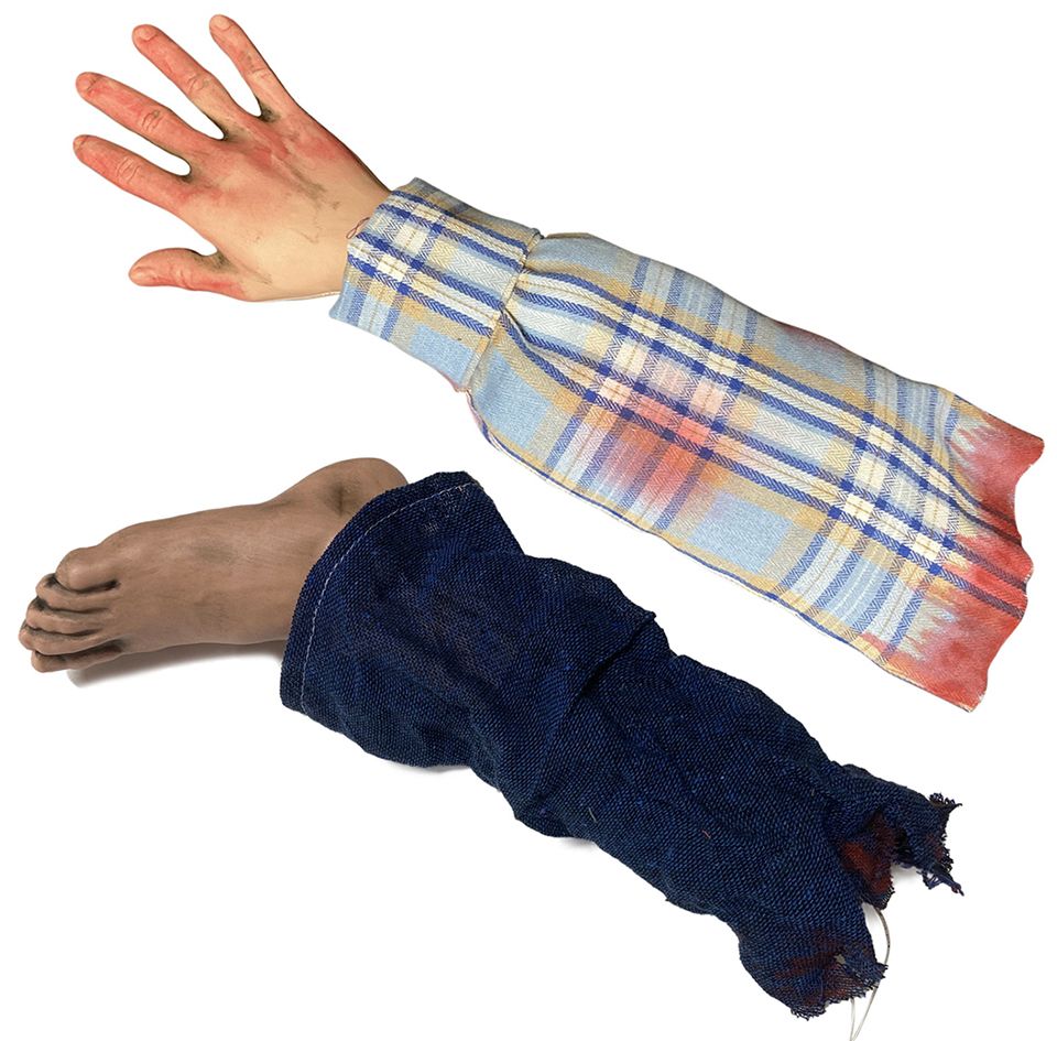 Shaking Arm or Leg