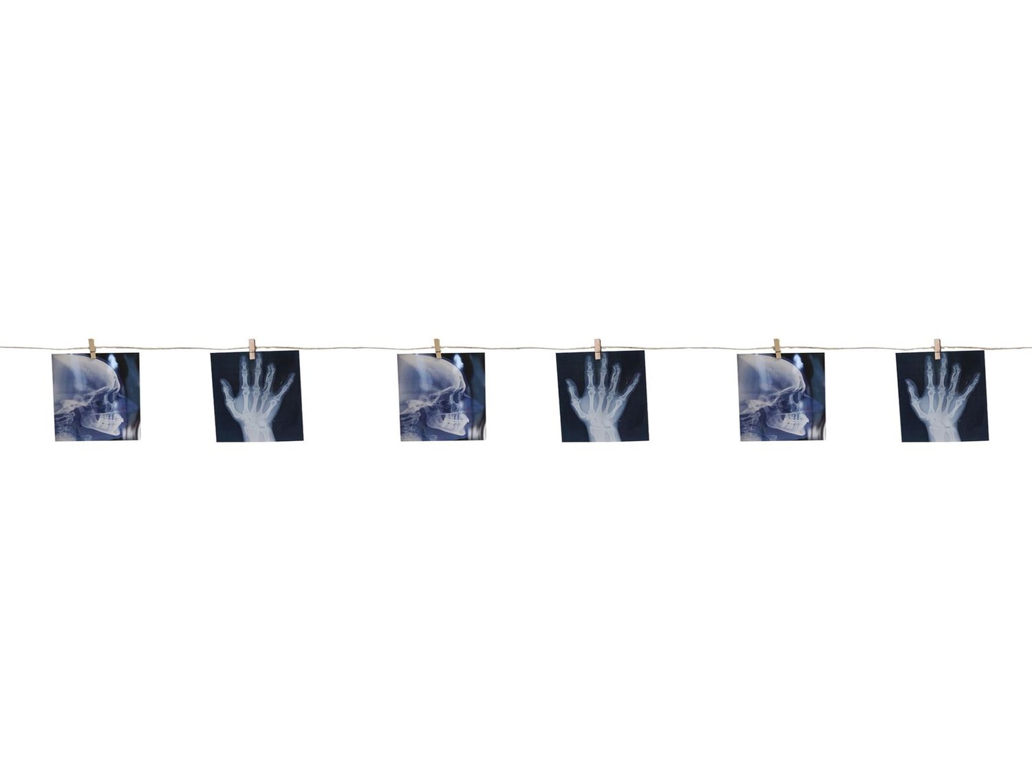 X-Ray Bone Garland