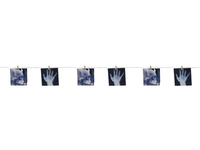 X-Ray Bone Garland