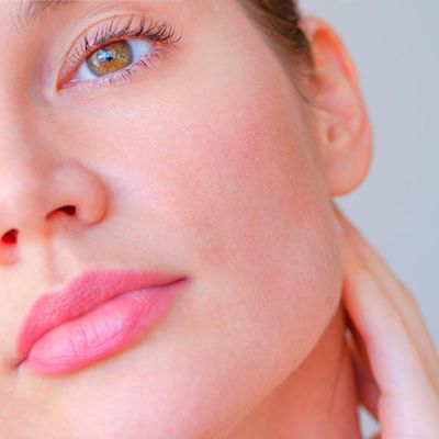 Ροδόχρους | Ευρυαγγείες