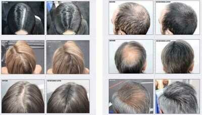 Before &amp; After